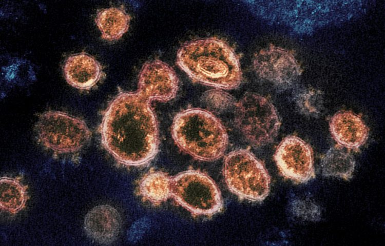 Electron microscope view of COVID coronavirus, CDC.